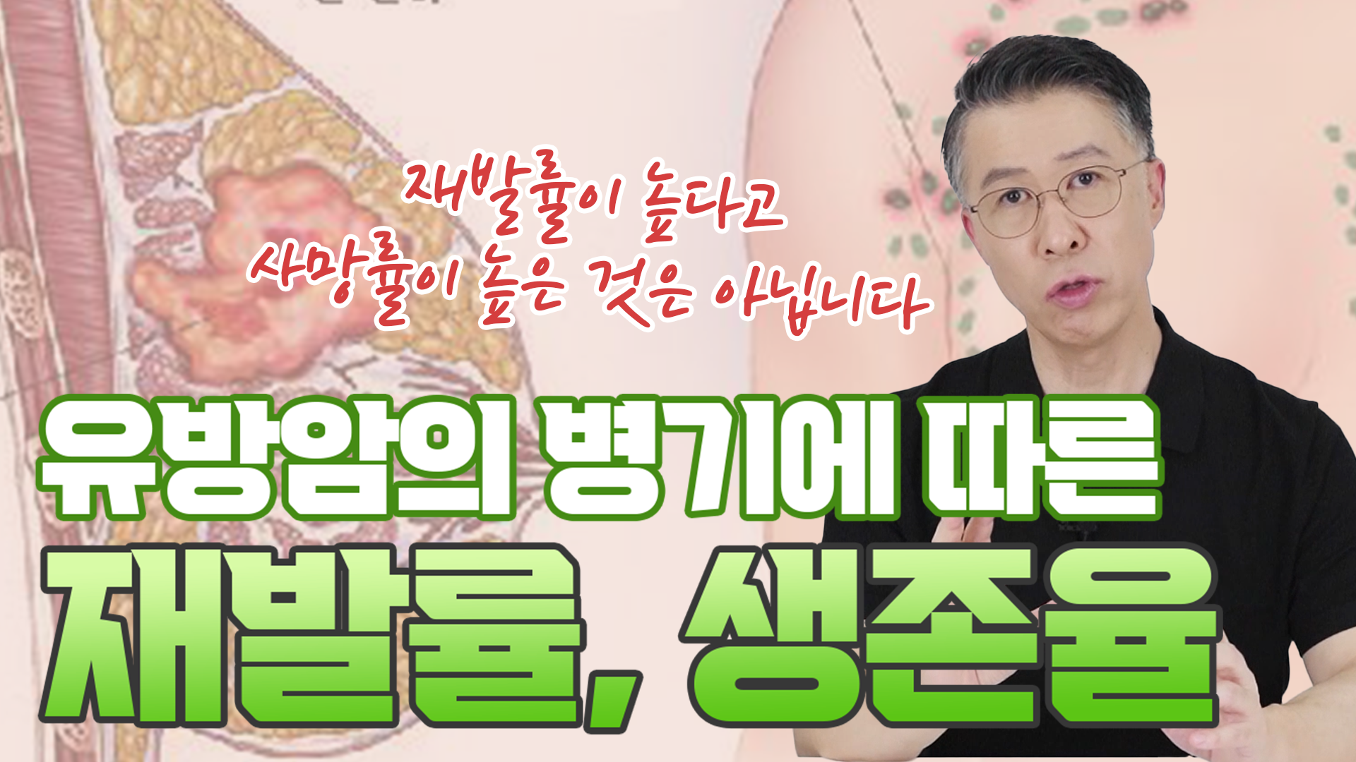 유방암 병기에 따른 재발률, 생존율은 얼마나 될까? (유방암 환자의 5년 생존…  
