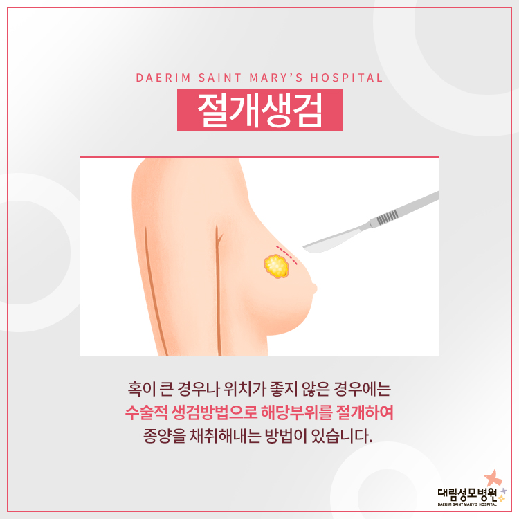 [유방센터] 유방섬유선종 5.jpg