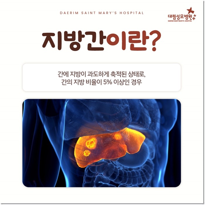 250225_대림성모병원_바이럴_지방간_(2).jpg