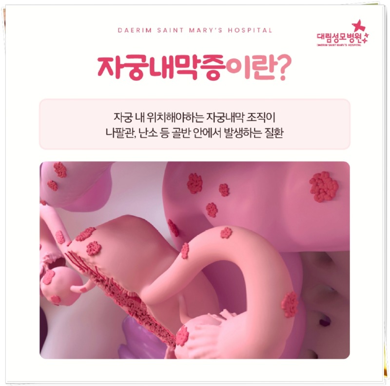 250730_대림성모병원_바이럴_자궁내막증_(2).jpg